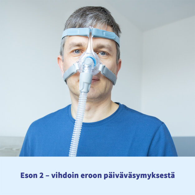 Fisher & Paykel Eson 2 CPAP nenämaski edestä02